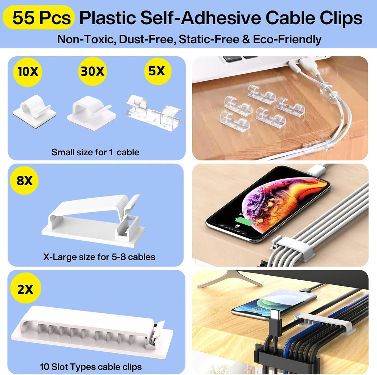 [] Cable Management Kit